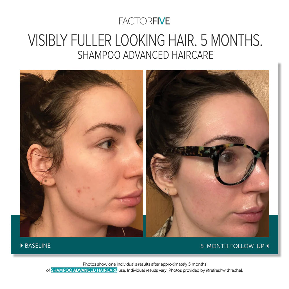 Factor Five Shampoo *PREORDER