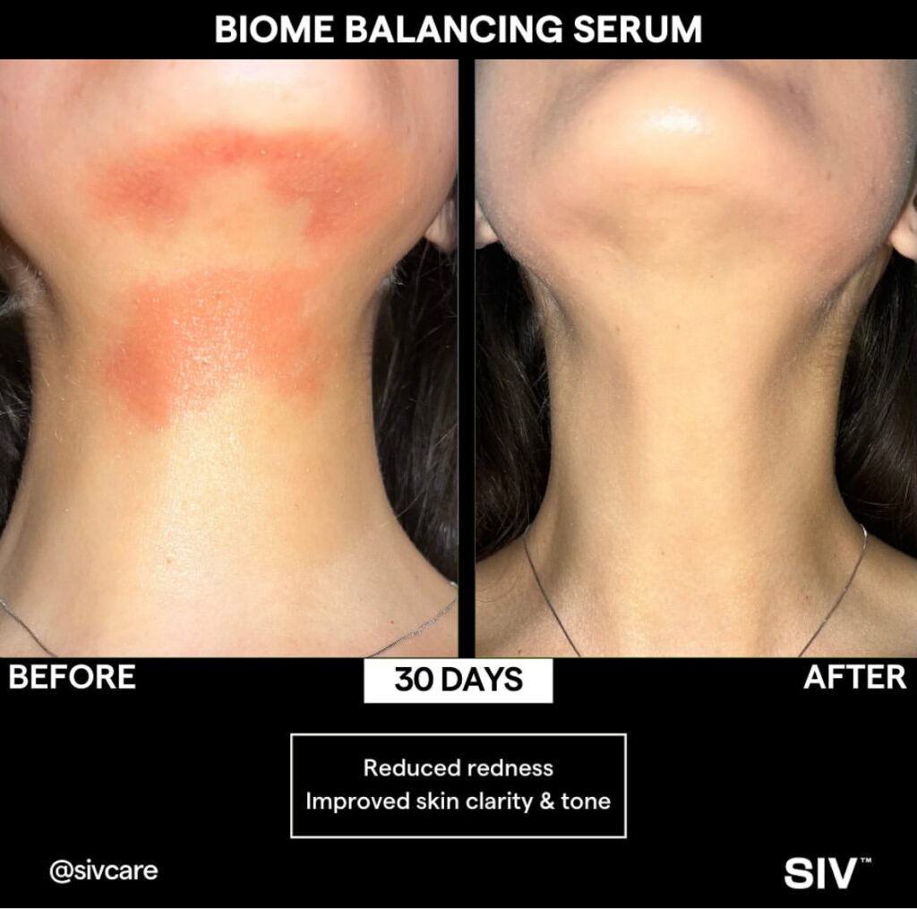 SIV Biome Balancing Serum