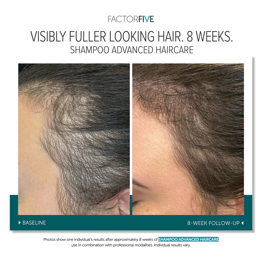 Factor Five Shampoo *PREORDER